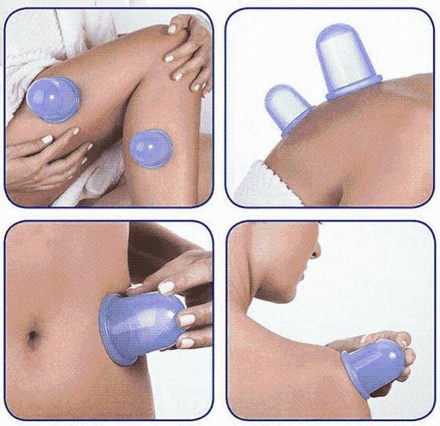 Anti Cellulite Vacuum Silicone Cups